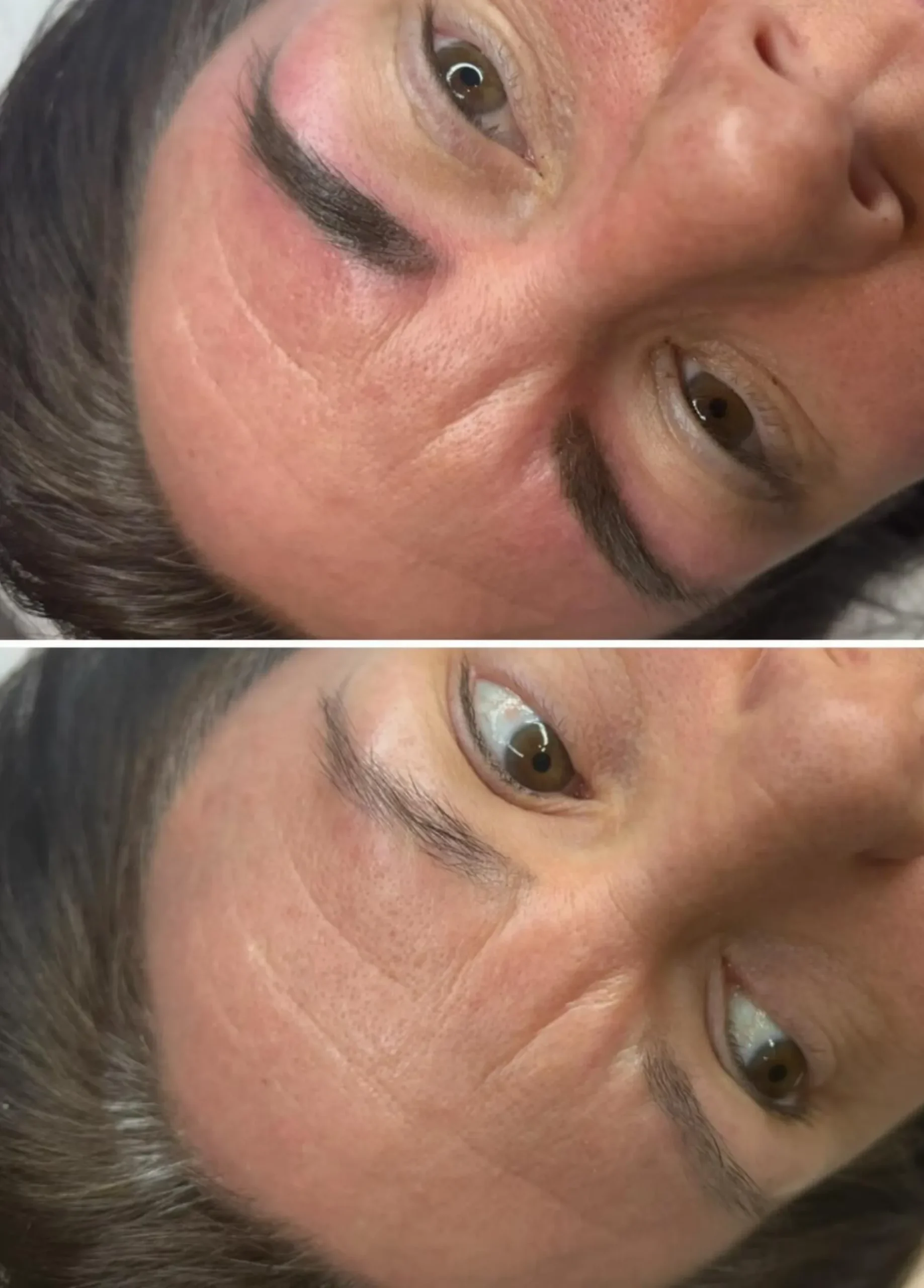 cosmetic tattoo Melbourne mature skin